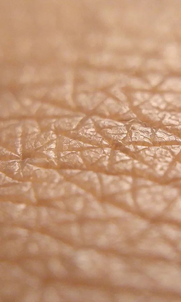 HA in the skin HA in the skin