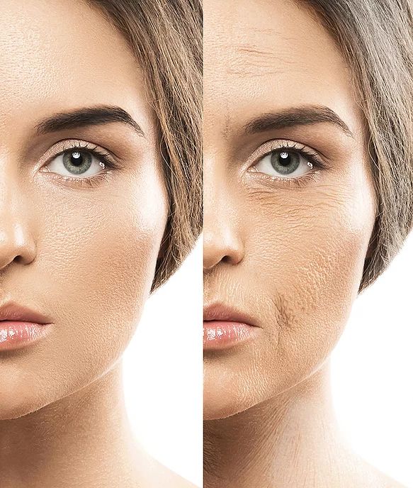 Decrease of HA in the skin Decrease of HA in the skin